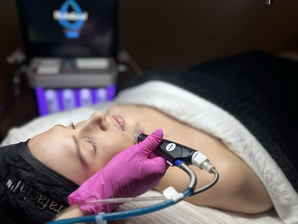 Woman receiving electric facial peeling at european beauty salon.